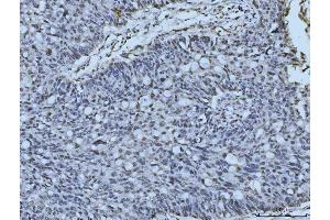 IHC analysis of MRE11 using anti-MRE11 antibody (ABIN7600025). (Mre11 antibody  (AA 14-481))