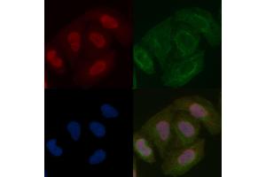 SSH3 Mouse Monoclonal Antibody staining Hela cells by IF/ICC.