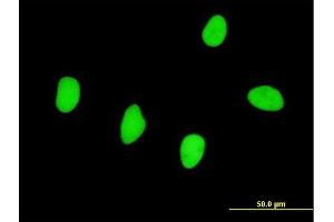 Immunofluorescence of monoclonal antibody to RBMS2 on HeLa cell.