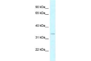 WB Suggested Anti-DHRSX Antibody Titration: 1. (DHRSX antibody  (N-Term))