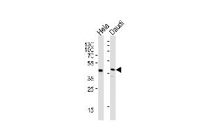 Western blot analysis of lysates from Hela,Daudi cell line (from left to right),using CREB3L4 Antibody (monoclonal) (M01) (ABIN1882056 and ABIN2838484).