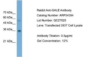 WB Suggested Anti-GALE  Antibody Titration: 0. (GALE antibody  (Middle Region))
