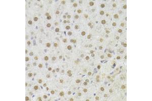 Immunohistochemistry of paraffin-embedded rat liver using HDGF Antibody (ABIN1876535) at dilution of 1:100 (40x lens). (HDGF antibody)