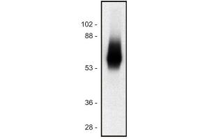 Western blot of human Jurkat T cell line