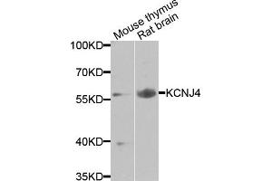 Western blot analysis of extracts of various cells, using KCNJ4 antibody. (KCNJ4 antibody)