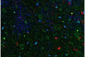 Image no. 1 for anti-Interleukin 11 (IL11) antibody (ABIN465009) (IL-11 antibody)