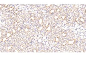 Immunohistochemistry (IHC) image for anti-Leptin Receptor (LEPR) (AA 238-375) antibody (ABIN7430879)