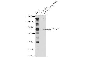 Immunoprecipitation analysis of 200 μg extracts of Jurkat cells, using 3 μg Phospho--S473 pAb (ABIN1513328, ABIN5664973, ABIN5664975 and ABIN6225474). (AKT1 antibody  (pSer473))