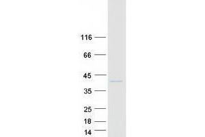 Western Blotting (WB) image for VAMP (Vesicle-Associated Membrane Protein)-Associated Protein A, 33kDa (VAPA) (Transcript Variant 1) protein (Myc-DYKDDDDK Tag) (ABIN2735170)