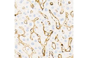 Immunohistochemistry of paraffin-embedded human liver using Annexin  Rabbit pAb  at dilution of 1:25 (40x lens). (Annexin A2 antibody)