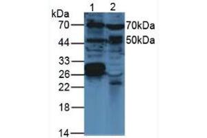 Western blot analysis of (1) Mouse Brain Tissue and (2) Mouse Breast Tissue. (VEGFC antibody  (AA 108-223))
