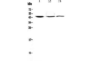 Western blot analysis of CD16 using anti-CD16 antibody .