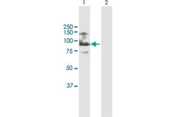 ASXL2 Antikörper  (AA 1-918)