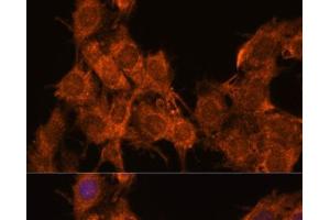 Immunofluorescence analysis of C6 cells using SNX15 Polyclonal Antibody at dilution of 1:100. (SNX15 antibody)