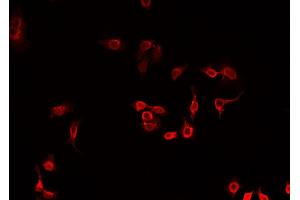 ABIN6269210 staining A549 cells by IF/ICC. (MARCKS antibody  (Internal Region))