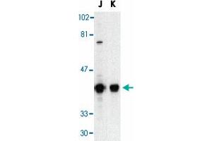 Western blot analysis of DFFB in Jurkat (J) and K-562 (K) whole cell lysate with DFFB polyclonal antibody  at 1 : 500 dilution. (DFFB antibody  (AA 3-18))