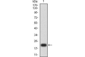 Western blot analysis using WT1 mAb against human WT1 (AA: 1-181) recombinant protein. (WT1 antibody  (AA 1-181))