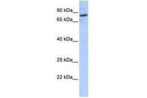Image no. 1 for anti-serine Palmitoyltransferase, Long Chain Base Subunit 2 (SPTLC2) (AA 72-121) antibody (ABIN6741036) (SPTLC2 antibody  (AA 72-121))