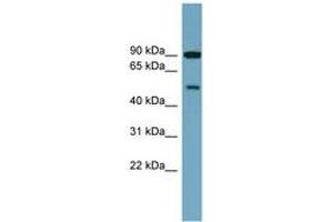 Image no. 1 for anti-Phosphatidylinositol 4-Kinase Type 2 beta (PI4K2B) (AA 143-192) antibody (ABIN6744142) (PI4K2B antibody  (AA 143-192))