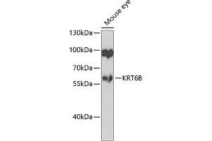 Western blot analysis of extracts of mouse eye, using KRT6B antibody (ABIN6129538, ABIN6143035, ABIN6143036 and ABIN6223626) at 1:1000 dilution. (Keratin 6B antibody  (AA 1-280))