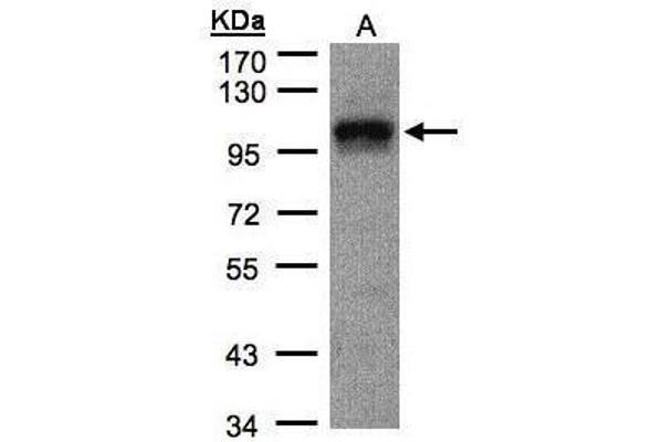 EIF4G2 anticorps  (N-Term)