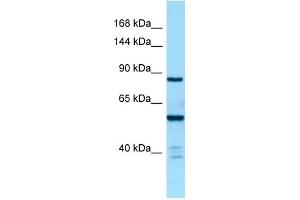 WB Suggested Anti-CTDP1 Antibody Titration: 1. (CTDP1 antibody  (C-Term))