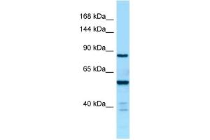 WB Suggested Anti-CTDP1 Antibody Titration: 1.