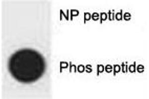 Dot blot analysis of p-p62 antibody. (SQSTM1 antibody  (pSer403))