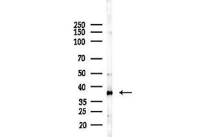 anti-Aldo-keto Reductase Family 1, Member C2 (AKR1C2) (N-Term) antibody
