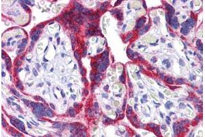 Human Placenta: Formalin-Fixed, Paraffin-Embedded (FFPE) (ATG9B antibody  (C-Term))