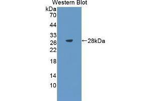 Detection of Recombinant SPA2, Rat using Polyclonal Antibody to Surfactant Associated Protein A2 (SPA2) (SFTPA2 antibody  (AA 21-248))