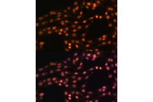 Immunofluorescence analysis of C6 cells using SUZ12 Polyclonal Antibody (ABIN6127300, ABIN6148752, ABIN6148754 and ABIN7101816) at dilution of 1:100 (40x lens). (SUZ12 antibody  (AA 470-739))