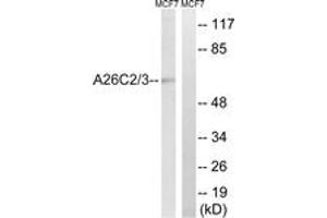 Western blot analysis of extracts from MCF-7 cells, using A26C2/3 Antibody. (A26C2/3 (AA 178-227) antibody)