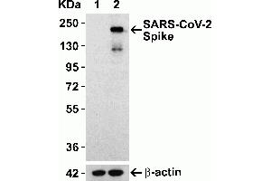 Western Blotting (WB) image for anti-SARS-CoV-2 Spike antibody (ABIN6952962)