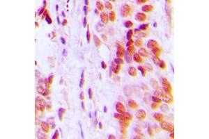 Immunohistochemistry (IHC) image for anti-Cyclin-Dependent Kinase Inhibitor 1C (p57, Kip2) (CDKN1C) (N-Term) antibody (ABIN7301558)