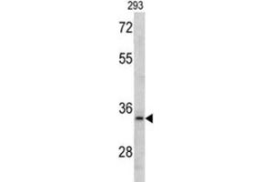 Western Blotting (WB) image for anti-DNA Segment, MCA1, Multiple CA Repeat 1 (MCA1) antibody (ABIN3002773) (MCA1 antibody)