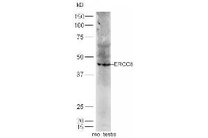 Mouse testis lysates probed with Rabbit Anti-ERCC*/CSA Polyclonal Antibody, Unconjugated (ABIN1713778) at 1:300 overnight at 4 °C. (ERCC8 antibody  (AA 161-260))