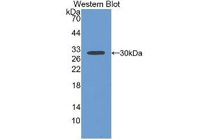 Western Blotting (WB) image for anti-Fibulin 1 (FBLN1) (AA 176-398) antibody (ABIN1175702) (Fibulin 1 antibody  (AA 176-398))