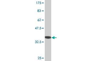 Western Blot detection against Immunogen (36. (B-Cell Linker antibody  (AA 301-400))