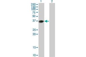 Western Blot analysis of BOLL expression in transfected 293T cell line by BOLL monoclonal antibody (M02), clone 1E3. (BOLL antibody  (AA 185-283))