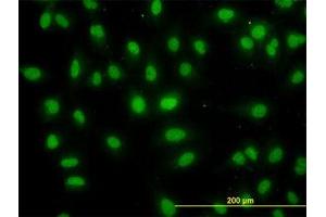 Image no. 5 for anti-DEAD (Asp-Glu-Ala-Asp) Box Polypeptide 56 (DDX56) (AA 450-548) antibody (ABIN599259) (DDX56 antibody  (AA 450-548))