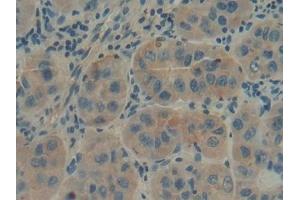 Detection of GBA in Human Liver Tissue using Polyclonal Antibody to Glucocerebrosidase (GBA) (GBA antibody  (AA 117-214))