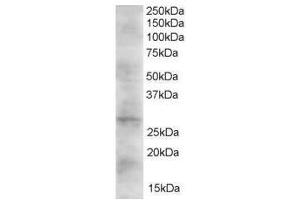 Image no. 1 for anti-Dickkopf 2 Homolog (DKK2) (C-Term) antibody (ABIN374181) (DKK2 antibody  (C-Term))