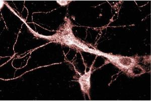 Rat Neurons (KIF3A antibody  (AA 563-671))