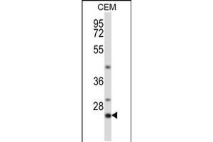 Western blot analysis in CEM cell line lysates (35ug/lane). (LIME antibody  (C-Term))