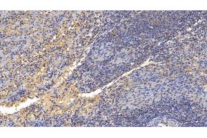 Detection of GITR in Human Spleen Tissue using Polyclonal Antibody to Glucocorticoid Induced Tumor Necrosis Factor Receptor (GITR) (Glucocorticoid Induced Tumor Necrosis Factor Receptor (AA 39-152) antibody)