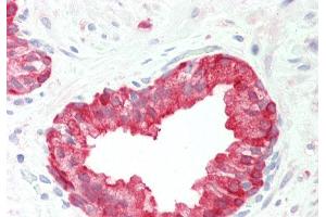 Rabbit Anti-PHGDH antibody Catalog Number: ARP54801 Formalin Fixed Paraffin Embedded Tissue: Human Prostate Primary antibody Concentration: 1:100 Secondary Antibody: Donkey anti-Rabbit-Cy3 Secondary Antibody Concentration: 1:200 Magnification: 20x Exposure Time: 0. (PHGDH antibody  (Middle Region))