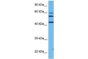 Host:  Rabbit  Target Name:  FOS  Sample Tissue:  Human DLD1 Whole Cell  Antibody Dilution:  1ug/ml (c-FOS antibody  (Middle Region))