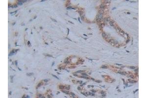 Detection of ALPL in Human Pancreas Tissue using Polyclonal Antibody to Alkaline Phosphatase, Tissue-nonspecific (ALPL) (ALPL antibody  (AA 18-335))