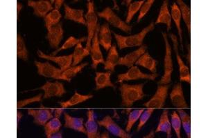 Immunofluorescence analysis of L929 cells using SEC23B Polyclonal Antibody at dilution of 1:100. (Sec23 Homolog B antibody)